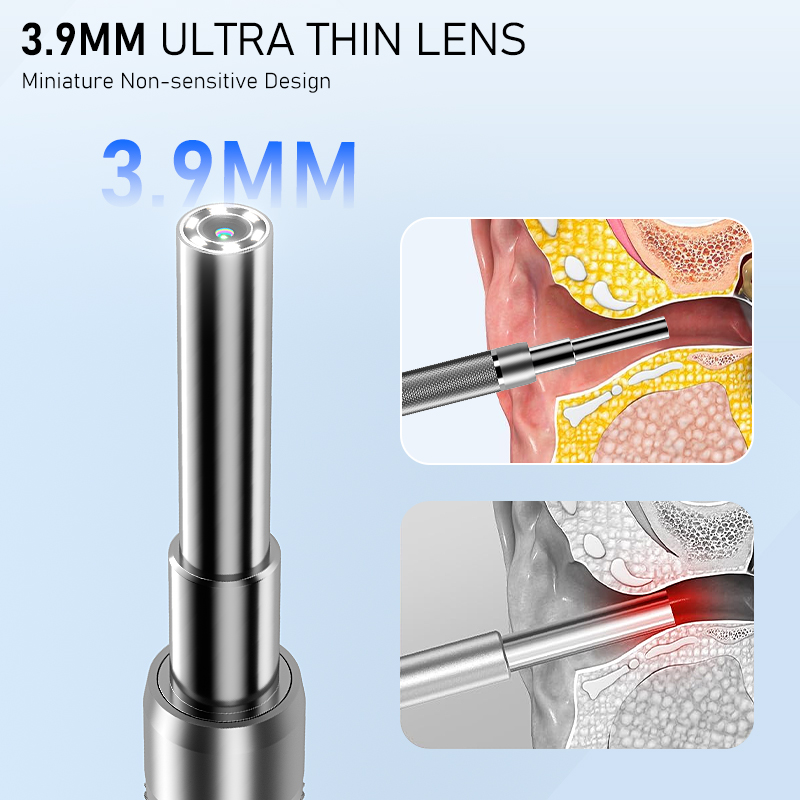 7 Inch Screen Ear Otoscope Cam - Screen Cleaning Kit 评论和价格